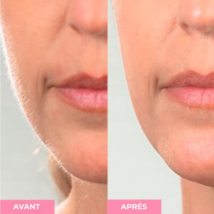 Épilateur pour le visage